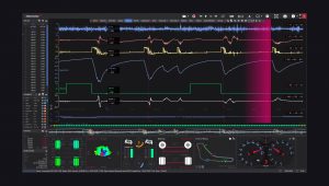 vtelemetry pro